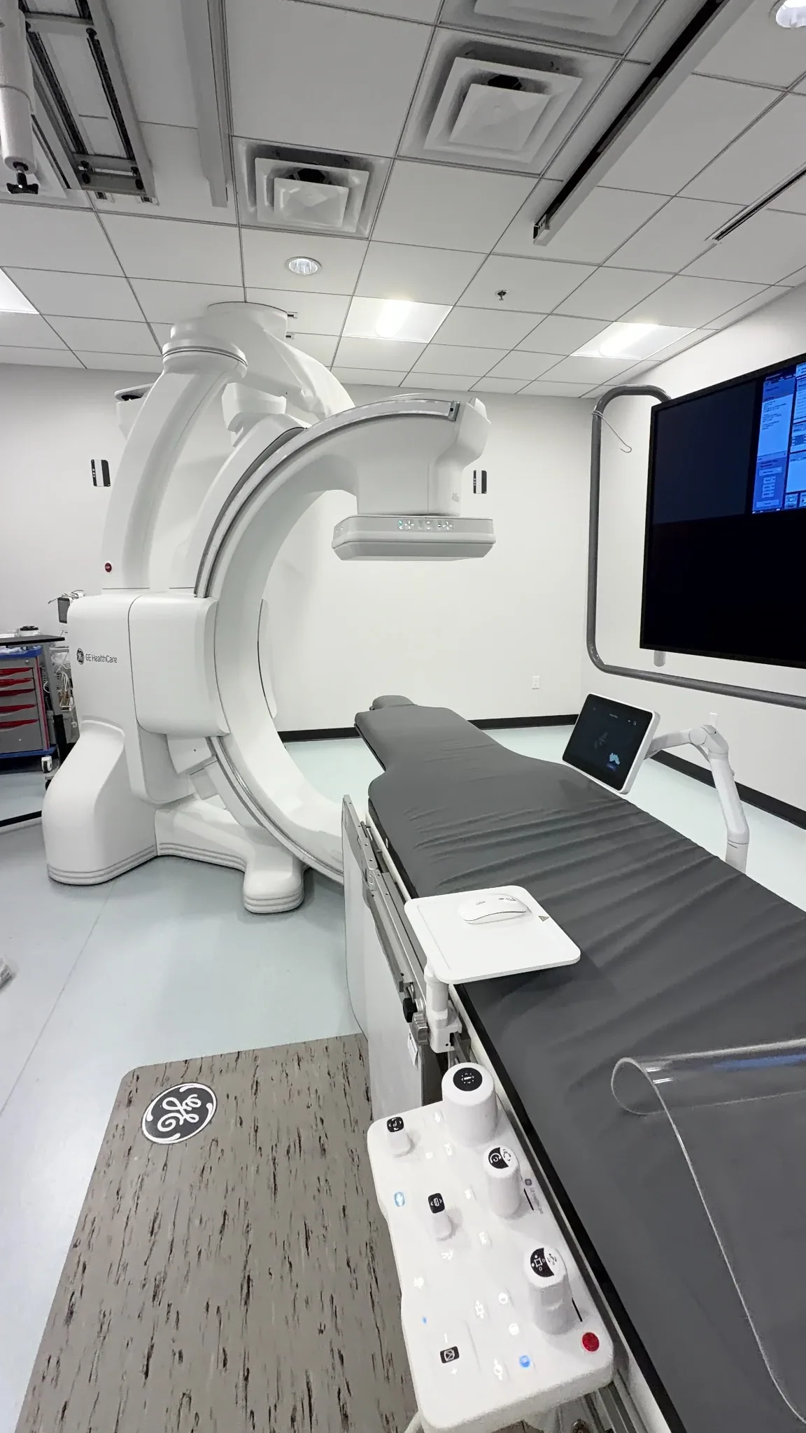 Interventional radiology procedure room with advanced imaging equipment used for minimally invasive embolization treatments.